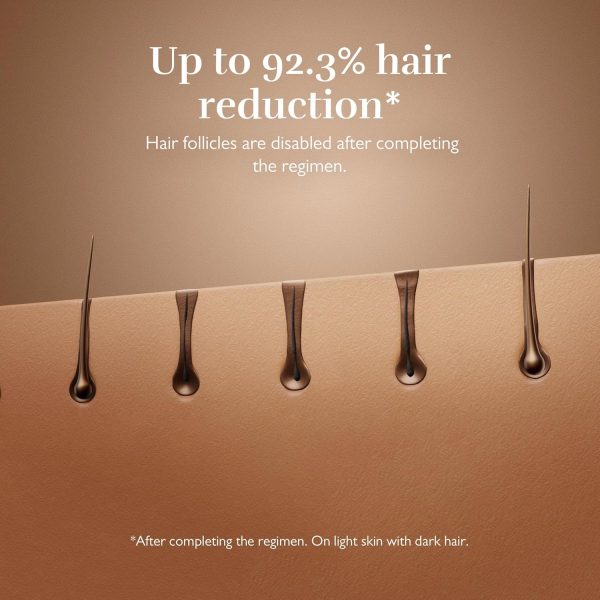 Silk'n Hair Removal Device for Women & Men I Silk'n 7 I Face and Body IPL - Image 2