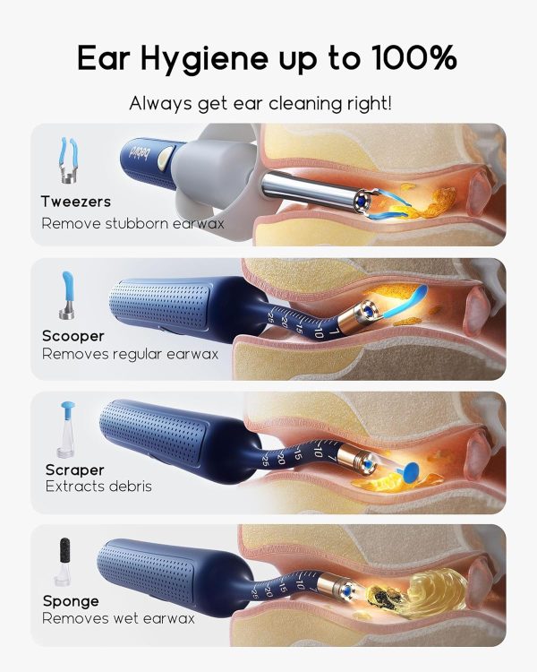 Bebird Earsight Plus Ear Cleaning Camera Wax Removal Tool kit, Flexible Ear - Image 5