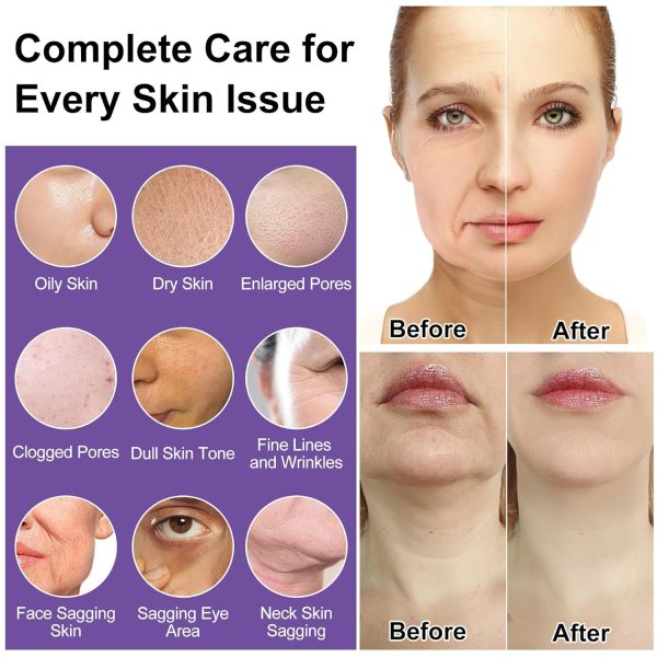 Skin Care Set,Korean Skincare for Women Teens Teenager - Image 2