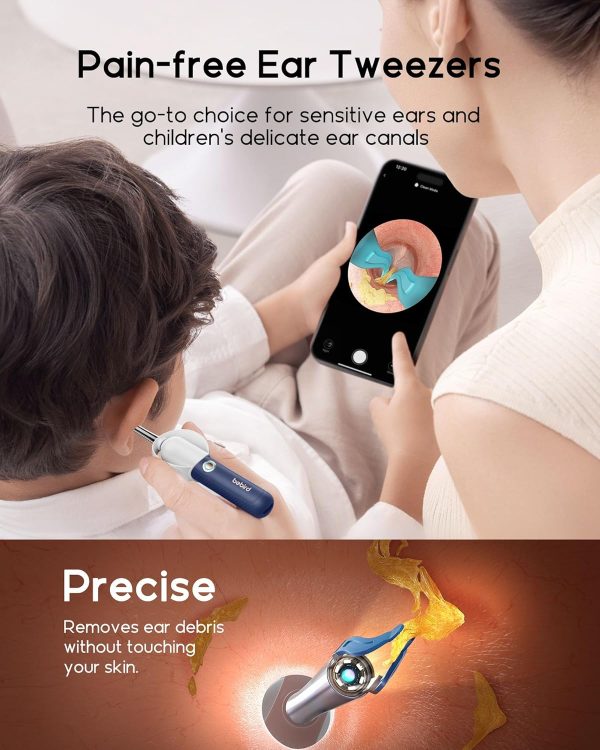 Bebird Earsight Plus Ear Cleaning Camera Wax Removal Tool kit, Flexible Ear - Image 4
