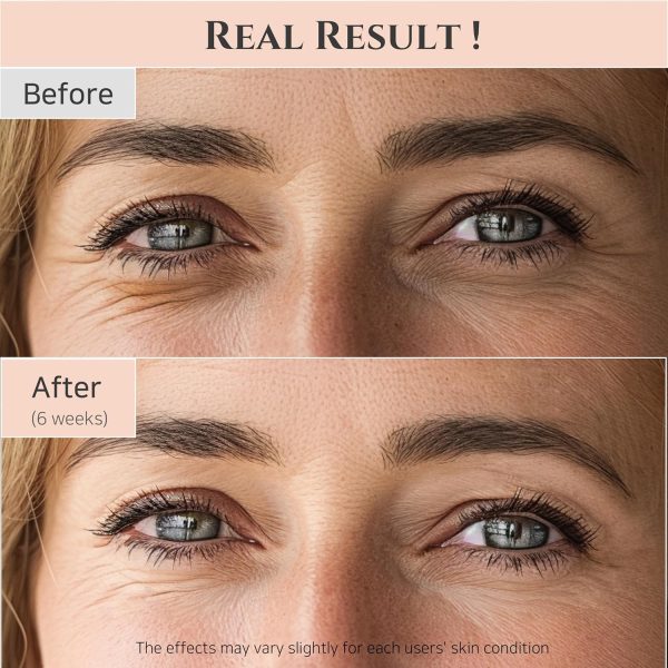 Beauty of Joseon Revive Eye Serum with Retinal Niacinamide Correction for - Image 5