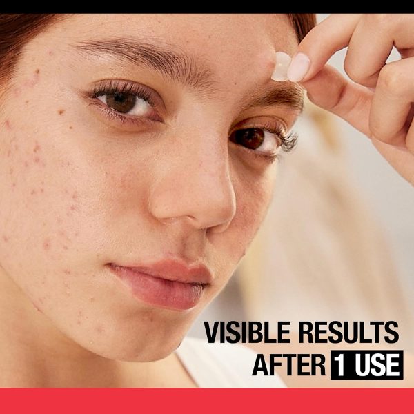 Neutrogena Stubborn Acne Blemish Patches, Ultra-Thin Hydrocolloid Acne - Image 2