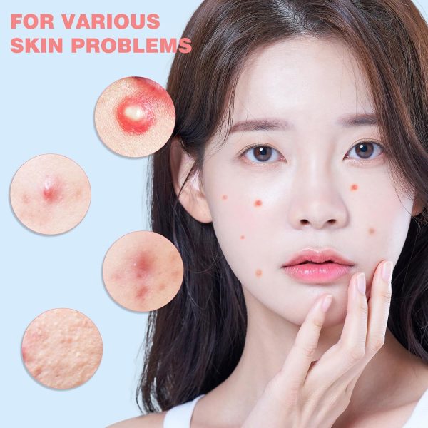 Pimple Patches for Face 360PCS, Hydrocolloid Acne Patches for Covering Zits - Image 3
